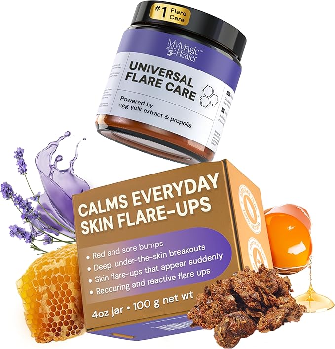 MyMagicHealer Universal Flare Care – Solution for Everyday Skin Flare-Ups | Drawing Salve for Boils & Cysts, Hidradenitis Suppurativa, Folliculitis | Irritated Skin and Chafing Relief 4 oz